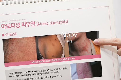생기한의원이 정리한 소아 아토피 피부관리 전 확인 사항